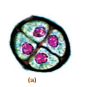 Figure 1.5 (a) Enlarged view of
a pollen grain tetrad